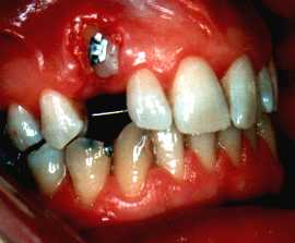 Klick zur�ck zum Text